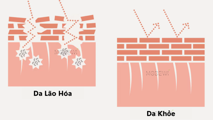 nếp nhăn biểu cảm 2