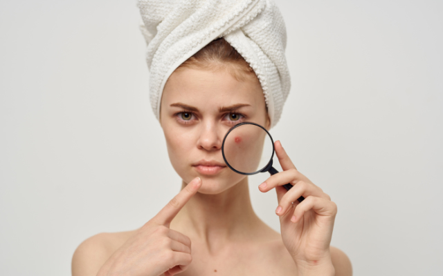 Các bước skincare cho người da mụn ban đêm