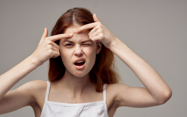 Nặn mụn xong nên làm gì? 